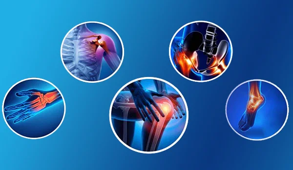 Orthopaedic Conditions